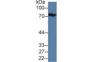 Western Blot; Sample: Human Serum; Primary Ab: 1µg/ml Rabbit Anti-Human JPH1 Antibody Second Ab: 0. (Junctophilin 1 anticorps  (AA 1-201))