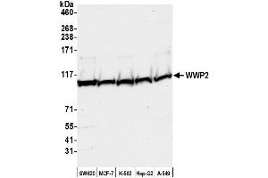 anti-WW Domain Containing E3 Ubiquitin Protein Ligase 2 (WWP2) (AA 200-250) antibody