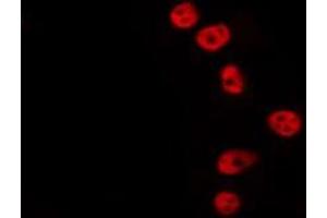 ABIN6275324 staining Hela by IF/ICC.