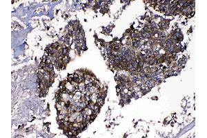 IHC analysis of MMP16 using anti-MMP16 antibody .