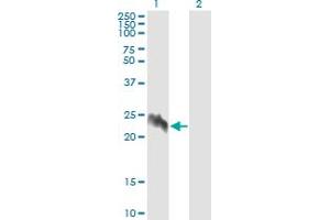 Western Blot analysis of EIF5A2 expression in transfected 293T cell line by EIF5A2 monoclonal antibody (M01), clone 1E7. (EIF5A2 anticorps  (AA 66-153))