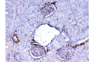 IHC testing of FFPE rat kidney tissue with Galectin 1 antibody at 1ug/ml.