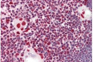 Anti-HnRNP K antibody IHC staining of human thymus. (HNRNPK anticorps  (AA 200-250))