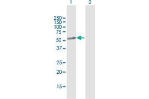 Western Blot analysis of CYP46A1 expression in transfected 293T cell line by CYP46A1 MaxPab polyclonal antibody.