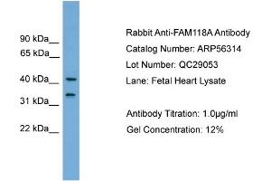 WB Suggested Anti-FAM118A  Antibody Titration: 0. (FAM118A anticorps  (Middle Region))