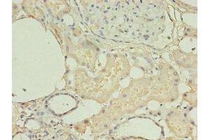 Immunohistochemistry of paraffin-embedded human kidney tissue using ABIN7155120 at dilution of 1:100