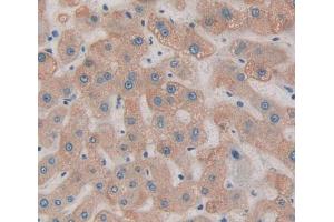 Figure. (THRSP anticorps  (AA 1-146))