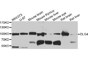 Western blot analysis of extracts of various cell lines, using DLG4 antibody (ABIN5975853) at 1/1000 dilution. (DLG4 anticorps)