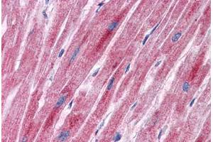 Human Heart: Formalin-Fixed, Paraffin-Embedded (FFPE)