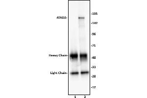 ATAD2 antibody (pAb) tested by Immunoprecipitation. (ATAD2 anticorps  (C-Term))