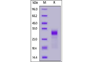 Biotinylated Human IL-33, His,Avitag on  under reducing (R) condition.