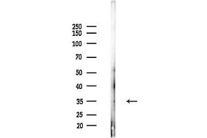 anti-ADP-Ribosyltransferase 4 (Dombrock Blood Group) (ART4) (N-Term) antibody