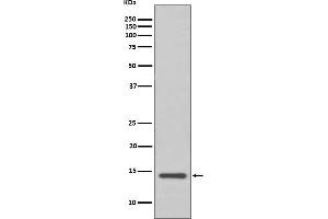 Western blot analysis of Cystatin C expression in HeLa cell lysate.