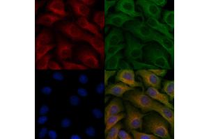 ABIN6257544 and ABIN6275649 staining Hela cells by IF/ICC. (Ubiquilin 3 anticorps  (Internal Region))