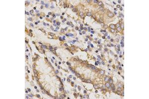 Immunohistochemistry of paraffin-embedded human stomach using TAPBP Antibody. (TAPBP anticorps)