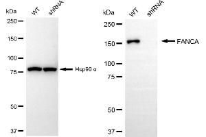 Western blotting analysis using FANCA antibody (ABIN7798563).