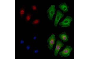 Phospho-RUNX2 (Ser319) Antibody staining A549 cells(4h of LPS treatment) by IF/ICC.