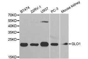 Western blot analysis of extracts of various cell lines, using GLO1 antibody. (GLO1 anticorps  (AA 1-184))