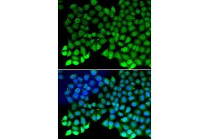 Immunofluorescence analysis of MCF7 cell using RPA1 antibody. (RPA1 anticorps  (AA 367-616))