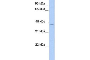 WB Suggested Anti-LASS4 Antibody Titration:  0. (LASS4 anticorps  (C-Term))