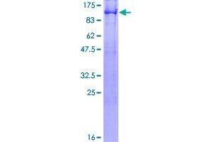 Image no. 1 for RalA Binding Protein 1 (RALBP1) (AA 1-655) protein (GST tag) (ABIN1317343)