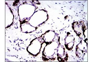 Immunohistochemical analysis of paraffin-embedded prostate tissues using CK5 mouse mAb with DAB staining.