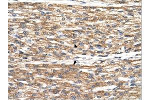 PNPLA3 antibody was used for immunohistochemistry at a concentration of 4-8 ug/ml.