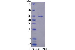 SDS-PAGE analysis of Mouse XYLT1 Protein. (XYLT1 Protéine)