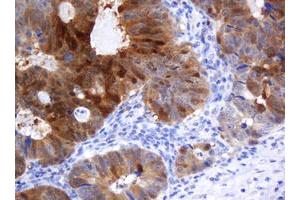 Image no. 1 for anti-Cytidine Monophosphate (UMP-CMP) Kinase 1, Cytosolic (CMPK1) antibody (ABIN1497546)