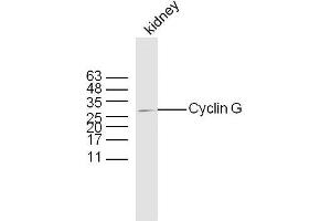 Mouse kidney lysates probed with Rabbit Anti-Cyclin G Polyclonal Antibody, Unconjugated  at 1:300 overnight at 4˚C. (Cyclin G1 anticorps  (AA 181-295))