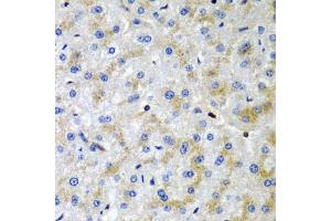 Immunohistochemistry of paraffin-embedded human liver damage using SRGN antibody (ABIN6132571, ABIN6148441, ABIN6148443 and ABIN6222700) at dilution of 1:200 (40x lens). (SRGN anticorps  (AA 28-158))