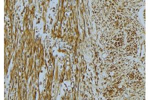 ABIN6268668 at 1/100 staining Mouse muscle tissue by IHC-P. (Vinculin anticorps  (N-Term))