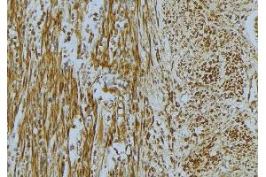 ABIN6268668 at 1/100 staining Mouse muscle tissue by IHC-P.