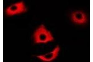 Immunofluorescent analysis of CDA staining in MCF7 cells.