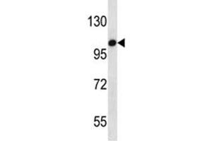 TLR7 antibody western blot analysis in HepG2 lysate