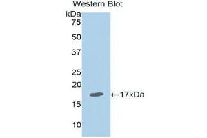 Western Blotting (WB) image for anti-Nuclear Receptor Subfamily 3, Group C, Member 1 (Glucocorticoid Receptor) (NR3C1) (AA 41-184) antibody (ABIN1174819)