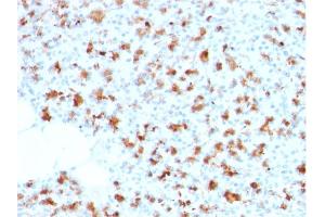 Formalin-fixed, paraffin-embedded human Pancreas stained with BARX1 Mouse Monoclonal Antibody (BARX1/2759). (BARX1 anticorps  (AA 155-254))