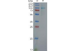 Human FAP (30-760) Protein, His Tag on SDS-PAGE under reducing condition.
