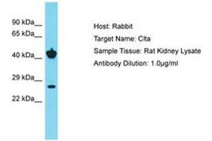 Image no. 1 for anti-Clathrin, Light Chain A/B (CLTA/CLTB) (C-Term) antibody (ABIN6750433) (CLTA/CLTB anticorps  (C-Term))