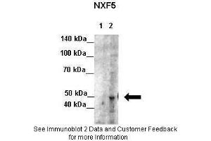 Lanes:   Lane 1: 7ug HeLa cystosolic extract  Lane 2: 7ug HeLa nuclear extract  Primary Antibody Dilution:   1:100  Secondary Antibody:   Anti-rabbit-HRP  Secondary Antibody Dilution:   1:500  Gene Name:   NXF5  Submitted by:   Seiji Masuda, Kitashirakawa Oiwakecho, Kyoto University (NXF5 anticorps  (Middle Region))