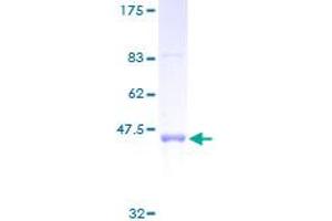 Image no. 1 for Prostaglandin E Synthase 3 (Cytosolic) (PTGES3) (AA 1-160) protein (GST tag) (ABIN1316743)