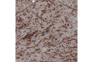 Immunohistochemical staining (Formalin-fixed paraffin-embedded sections) of human substantia nigra pars reticulata with SLC32A1 monoclonal antibody, clone CL2793  shows positivity in GABAergic neural fibers. (SLC32A1 anticorps)