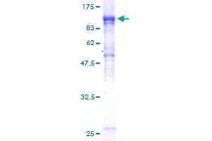 Image no. 1 for Nucleoporin 85kDa (NUP85) (AA 1-656) protein (GST tag) (ABIN1313244)