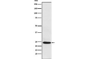 Western blot analysis of BAG2 expression in HepG2 cell lysate.