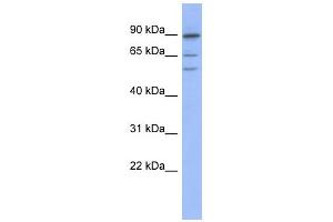 WB Suggested Anti-TRIM50 Antibody Titration:  0. (TRIM50 anticorps  (Middle Region))
