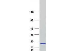 Validation with Western Blot