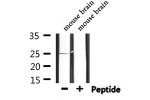 Western blot analysis of extracts from mouse brain, using PRDX6 Antibody. (Peroxiredoxin 6 anticorps  (Internal Region))