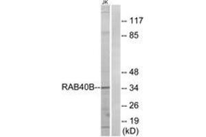 Western blot analysis of extracts from Jurkat cells, using RAB40B Antibody. (RAB40B anticorps  (AA 229-278))