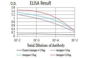 Black line: Control Antigen (100 ng),Purple line: Antigen (10 ng), Blue line: Antigen (50 ng), Red line:Antigen (100 ng)