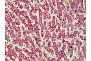 Human Liver: Formalin-Fixed, Paraffin-Embedded (FFPE) (ANTXR2 anticorps)